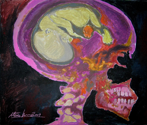 Cranial pregnancy 2 (Sold)
Acrylics on canvas.

Copyright © M. Larsson. All rights reserved.
