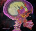 cranialpregnancy2.jpg